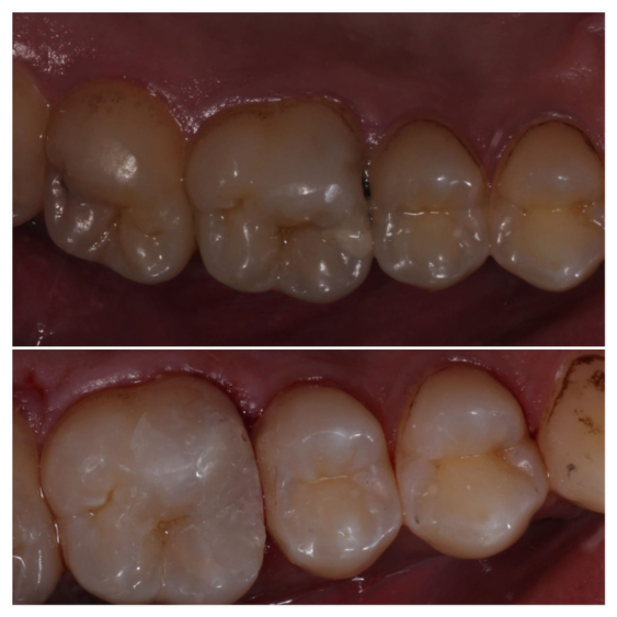 Cosmetic Dentist in Mahalaxmi Nagar Indore